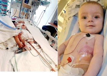 Canada: Un bébé de 6 mois opéré 3 fois au coeur Photos
